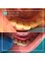 DentalHD Odontologia de Alta Estetica - A small procedure is going to make a big change  