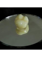 Dental Crowns. Zirconia or Emax. (CAD/CAM Dental Restorations) - Dentaria