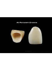 Porcelain Crown - Evolution Dental Care