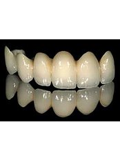 Dental Bridges - Evolution Dental Care