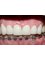 Grupo Interdisciplinario Odontológico - After Orthodontic treatment and Zirconium Crowns 