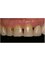 Smile Specialists Dental Clinic - CALLE 20 #323 x 19a Y 21 LOS ALAMOS, Mérida, Yucatán, 97138,  11