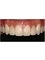 Smile Specialists Dental Clinic - CALLE 20 #323 x 19a Y 21 LOS ALAMOS, Mérida, Yucatán, 97138,  14