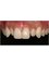 Smile Specialists Dental Clinic - CALLE 20 #323 x 19a Y 21 LOS ALAMOS, Mérida, Yucatán, 97138,  13