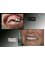 Dental Brush - Mexicali Office - Avenida Francisco y Madero # 366 Int A, Zona Centro 21100, Mexicali, Baja California, 21100,  20