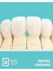 Dental Crowns - Estrada Dental Group