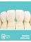 Estrada Dental Group - Porcelain and zirconia available. 
