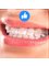 Estrada Dental Group - Clear self ligating brackets. 