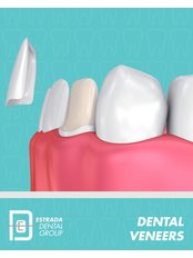Veneers - Estrada Dental Group