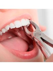 Normal Extractions - Simply Dental - Mexicali