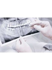 Dental X-Ray - Simply Dental - Mexicali