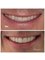 Esthetic Dental - Heriberto Frias 832, CDMX, Distrito Federal, 03020,  1