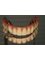 Implants Dental Center - Pestalozzi 1204-905 Col. Del Valle, Mexico D.F, Distrito Federal, 03100,  0