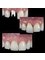 Implants Dental Center - Pestalozzi 1204-905 Col. Del Valle, Mexico D.F, Distrito Federal, 03100,  4