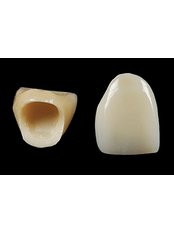 Porcelain Crown - Dental Laser Nogales