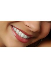 Veneers - Dental Laser Nogales