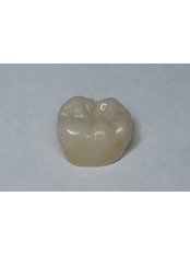 Zirconia Crown - Dental Laser Nogales