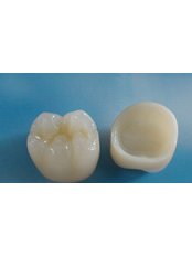 Porcelain Crown - Dental Line