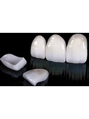 Porcelain Veneers - Dental Line