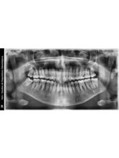 Dental X-Ray - Dental Line