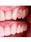 Prime Dental Nogales - Dr Nehemias Mendivil - Av. Obregon 19 Suite C, Nogales, Sonora, 84030,  4