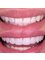 Prime Dental Nogales - Dr Nehemias Mendivil - Av. Obregon 19 Suite C, Nogales, Sonora, 84030,  2