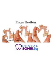 Flexible Partial Dentures - Dental Sonriza