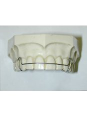 Orthodontic Retainer - Dental Sonriza