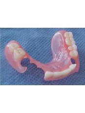 Flexible Partial Dentures - America Dental Clinic