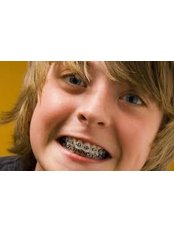 Child Braces - Aqua Dental