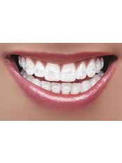 Clear Braces - Aqua Dental