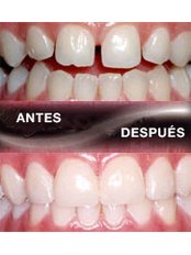 Cosmetic Dentist Consultation - Aqua Dental
