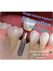 Single Implant - CAD/CAM Cosmetic Technology, Dental Artistry Dental Center