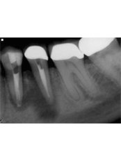 Dental X-Ray - CAD/CAM Cosmetic Technology, Dental Artistry Dental Center