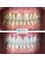 CAD/CAM Cosmetic Technology, Dental Artistry Dental Center - Cosmetic Dentistry  