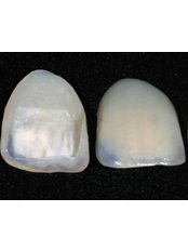 Porcelain Veneers - CAD/CAM Cosmetic Technology, Dental Artistry Dental Center