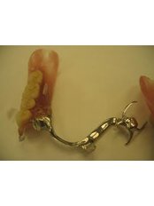 Fixed Partial Dentures - CAD/CAM Cosmetic Technology, Dental Artistry Dental Center