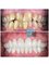 CAD/CAM Cosmetic Technology, Dental Artistry Dental Center - 28 zirconium crowns 