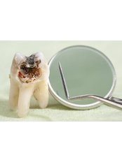 DENTAL EXTRACTIONS - Dental World Dental Centers