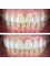 Dental World Dental Centers - Dental Venters 