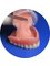 Dr. Castle Implant, Orthodontic and Cosmetic Dentistry Center - Denture reline 
