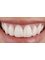 Dr. Castle Implant, Orthodontic and Cosmetic Dentistry Center - Smile design 