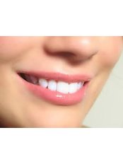 Laser Teeth Whitening - Dra. Luz Marely García Alvarez