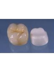 Zirconia Crown - Eagle Dental Clinic (extreme makeovers)