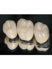 Dental Crowns - Eagle Dental Clinic (extreme makeovers)