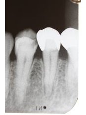 Dentist Consultation - Munoz Dental Care