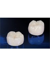 Permanent Crown - Munoz Dental Care