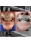 Pro Dental Clinic Mx - Complete restoration of zirconias 