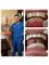 Progreso Smile Dental Center - Cosmetic rehabilitation with 16 upper and lower metal porcelain crowns 