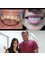 Progreso Smile Dental Center - Veneers and Full porcelain crowns 